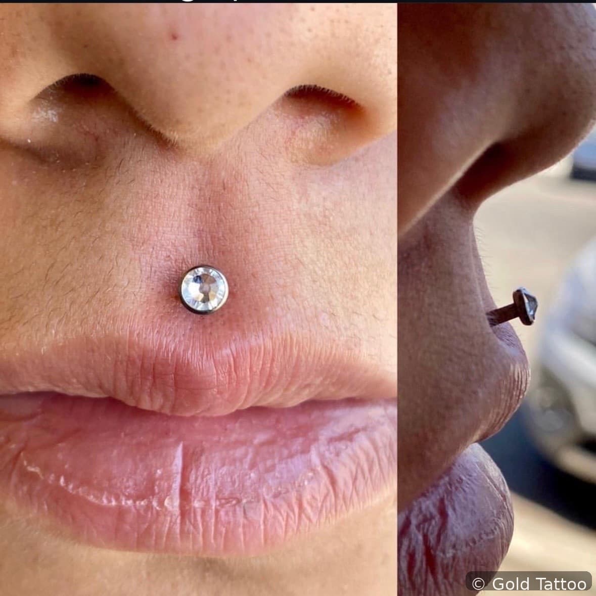 Medusa piercing by Jordan at Gold Tattoo Vegas, downtown Las Vegas